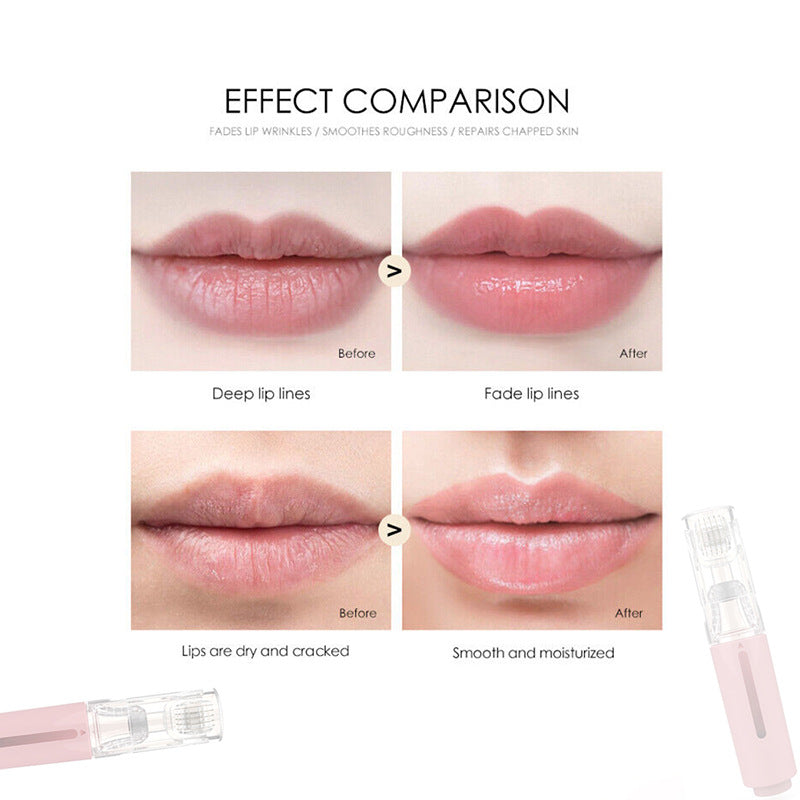 3 In 1 Lip Care Roller Needle Roller